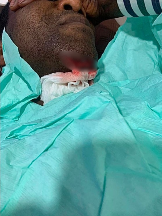 Kenpong hospitalised with serious injuries following bathroom fall at Accra home