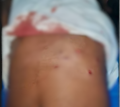 Armed gang shoots two in Central Region mobile money heist; roadblock terror follows