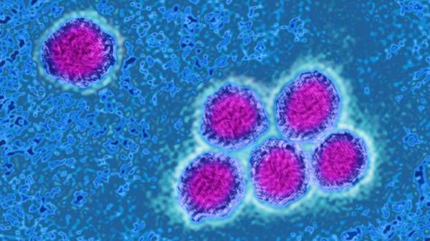 Yellow Fever Deaths in Sissala East: MP Demands Answers as Municipality Battles Outbreak